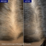 Jenpharm Anagrow Shampoo – Reduces Hair Fall & Boosts Growth