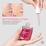 Anua - Niacinamide 10% + TXA 4% Serum | Bright & Clear Skin 30ml