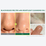 Pore Control Cleansing Oil 200ml | Anua