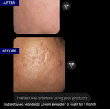 Jenpharm MandelAC Cream