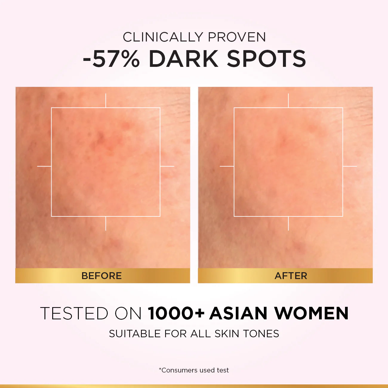 Loreal Glycolic Bright Face Serum – Instant Glow | 15ml